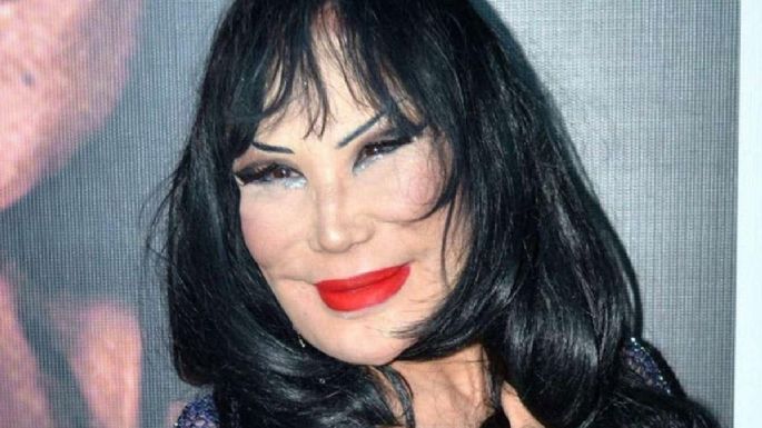 ¿Botox o filtro? Lyn May reaparece irreconocible en pleno embarazo