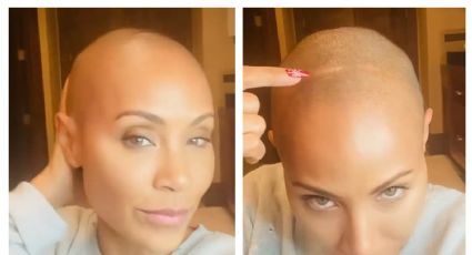 Jada Pinkett Smith revela que tiene esta terrible enfermedad que le hace perder el cabello