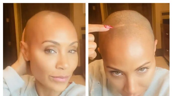 Jada Pinkett Smith revela que tiene esta terrible enfermedad que le hace perder el cabello