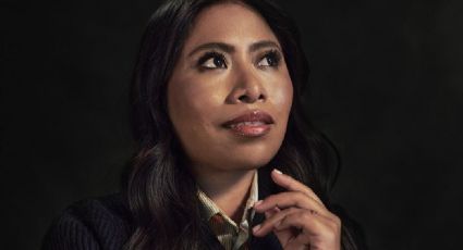 VIDEO: Yalitza Aparicio revela que padece enfermedad en la piel; esto provoca su padecimiento