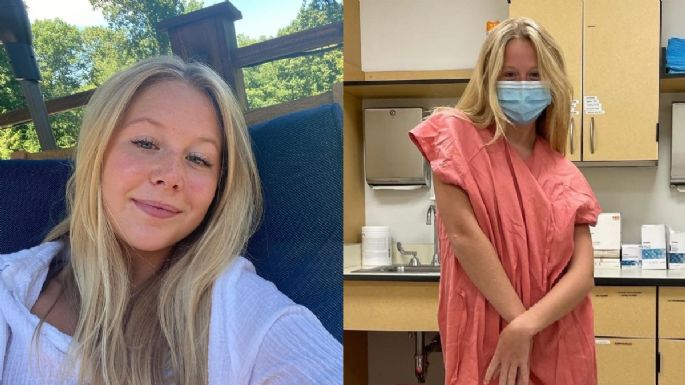 Actriz de 'Anne with an E' revela lo más duro de tener cáncer a sus 19 años de edad