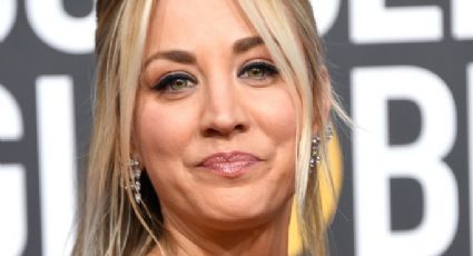 A Kaley Cuoco casi le amputan una pierna por este “devastador” accidente