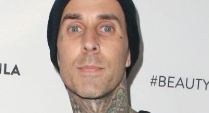 Travis Barker se rompe otra vez el dedo y así se le ve