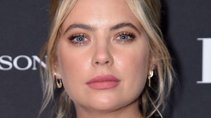 Ashley Benson muestra su piel llena de ronchas y revela la causa