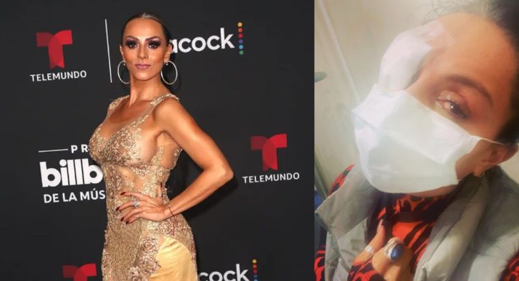 Casi queda ciega: Actriz de Televisa sufre terrible accidente y en 'VLA' da detalles de su salud