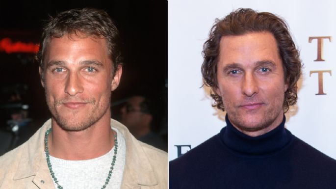 Matthew McConaughey finalmente habla sobre los rumores de que tiene trasplante de cabello