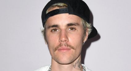 Terrible: Medio rostro de Justin Bieber se paraliza debido a un raro trastorno