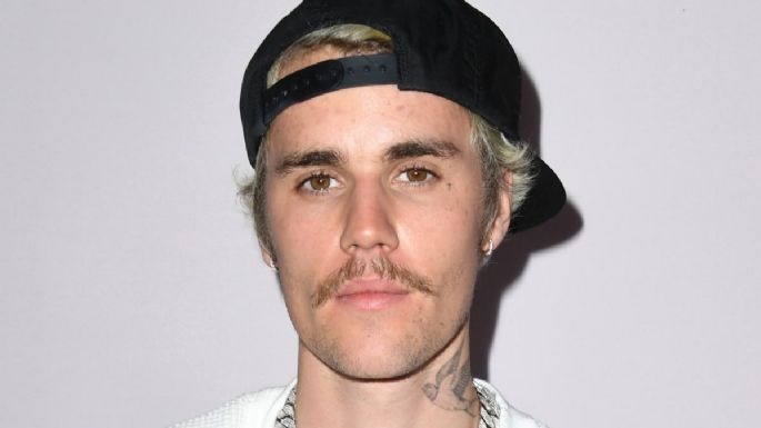 Terrible: Medio rostro de Justin Bieber se paraliza debido a un raro trastorno