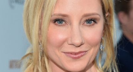 FOTOS: Tras chocar y provocar un terrible incendio, la actriz Anne Heche se reporta estable