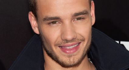 Liam Payne aparece con rostro perfilado y expertos revelan lo que se habría hecho