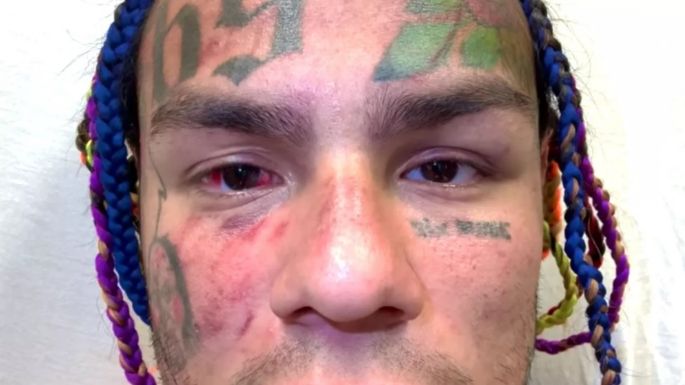 El rapero Tekashi 6ix9ine muestra por primera vez un fuerte video de la golpiza en el gimnasio