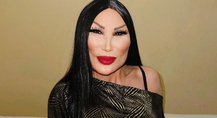 Lyn May sufre fuerte golpe en la cabeza durante la filmación de 'Grandes Hits'; así se encuentra