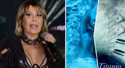 Alejandra Guzmán es hospitalizada de nueva cuenta; hay incertidumbre sobre su estado de salud